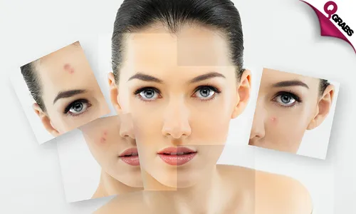 Derma Treatments!